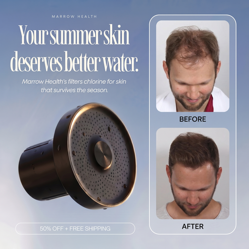 The Marrow Pro Filtered Showerhead Matte Black